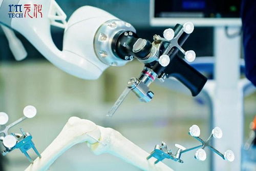 科技賦能醫療新未來 元化智能錕铻全骨科手術機器人閃耀進博會